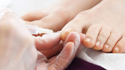 Orthotic Clinic Podiatrist Chiropodist