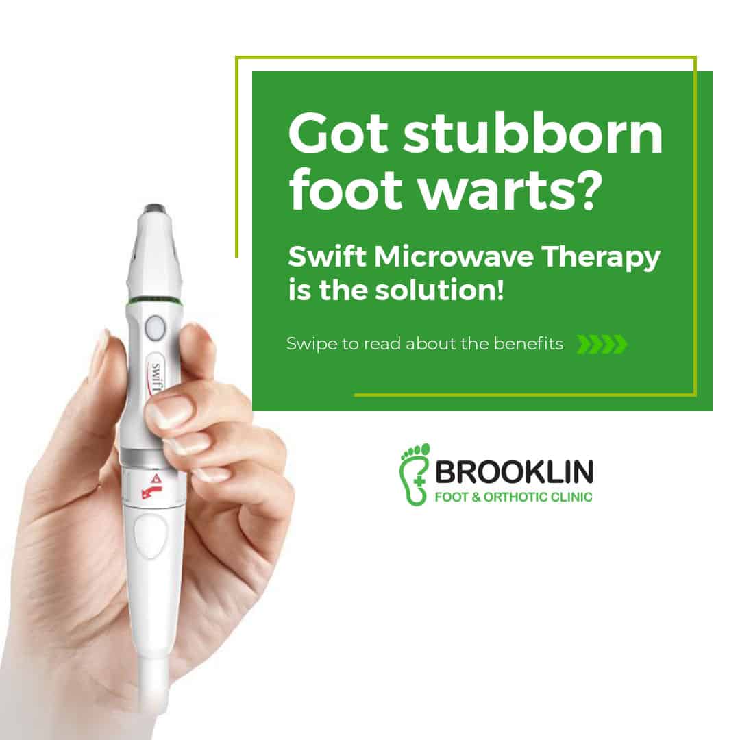 Swift Microwave Therapy For Plantar Wart
