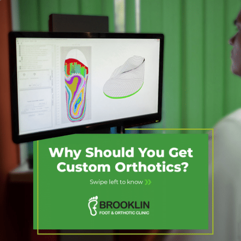 custom orthotics