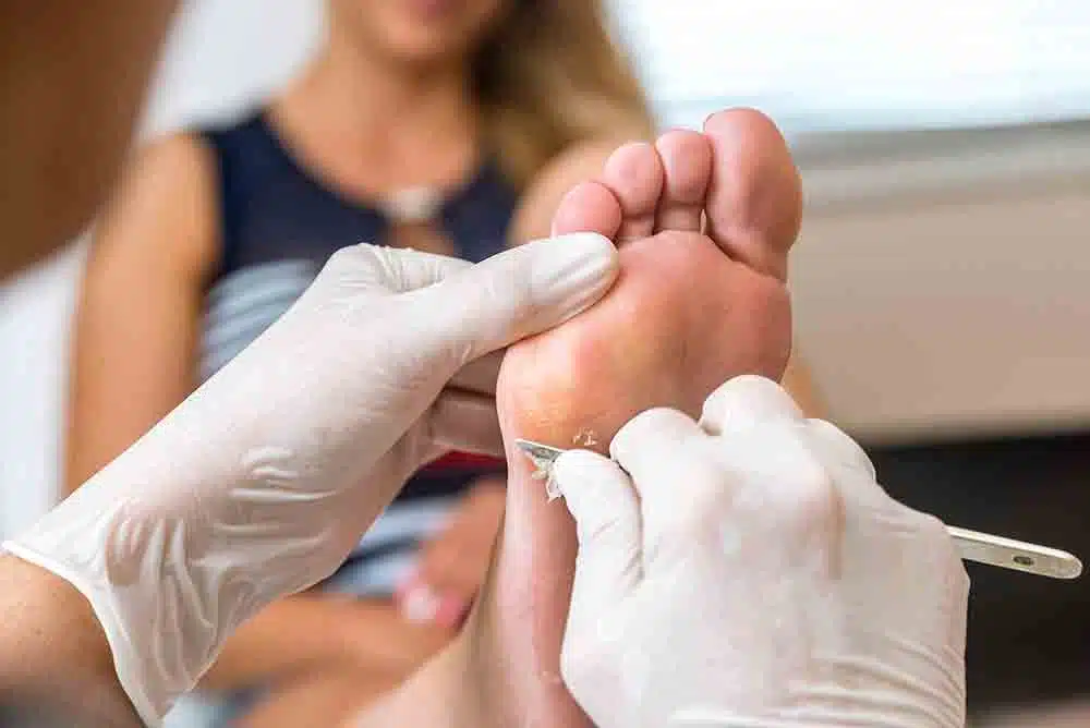 foot surgical procedures