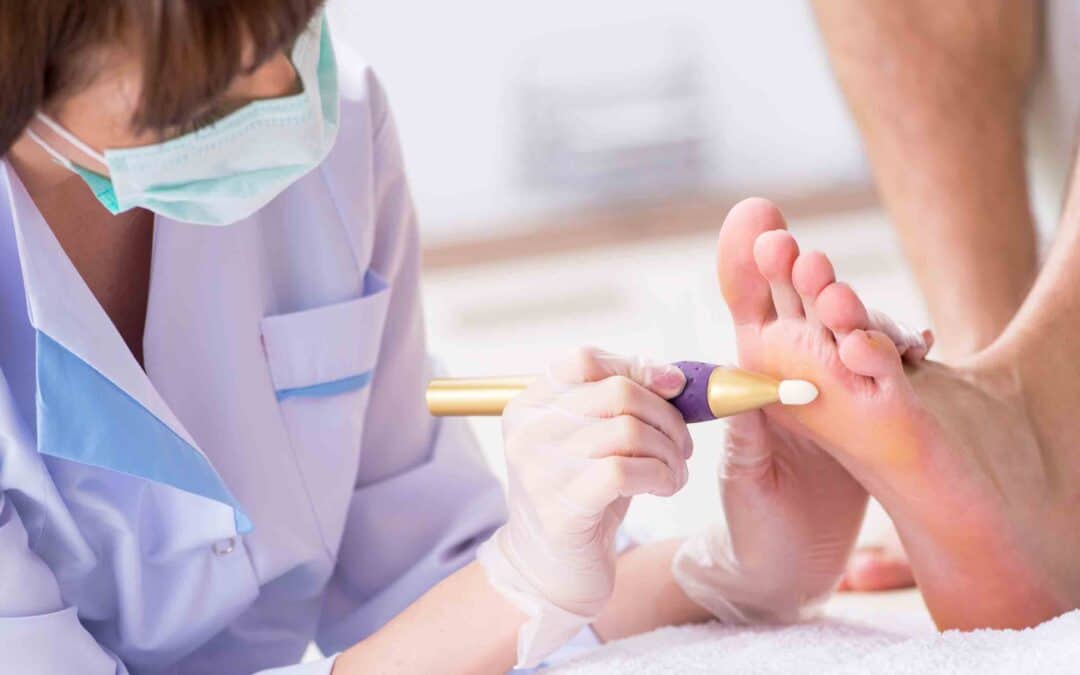 What’s the Difference Between a Podiatrist and a Chiropodist? In a nutshell – not much!