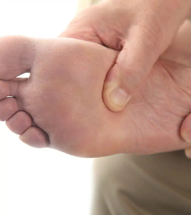 Arch-Heel-Pain