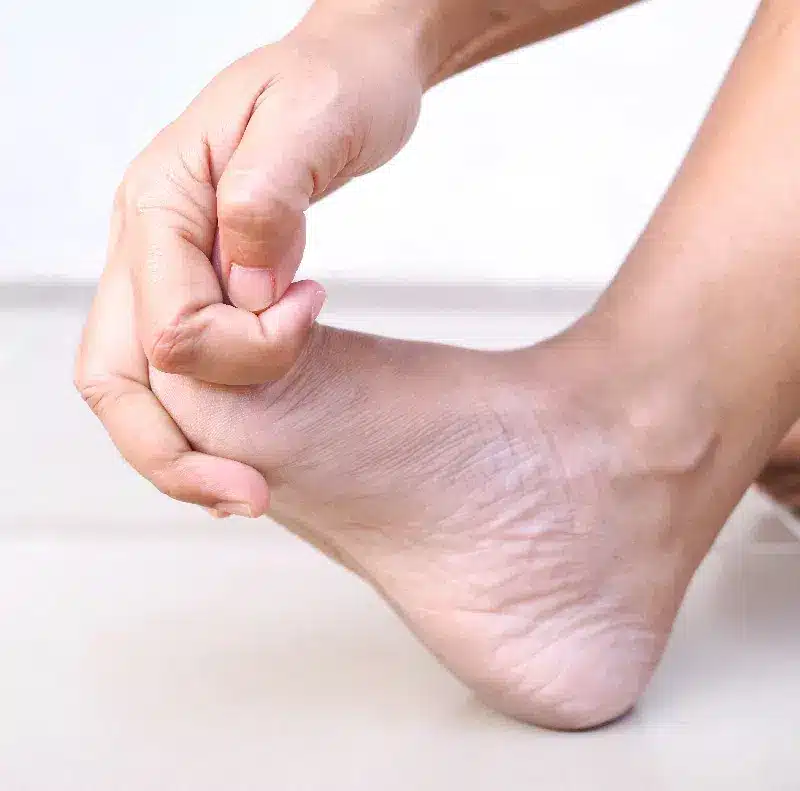 foot-arthritis