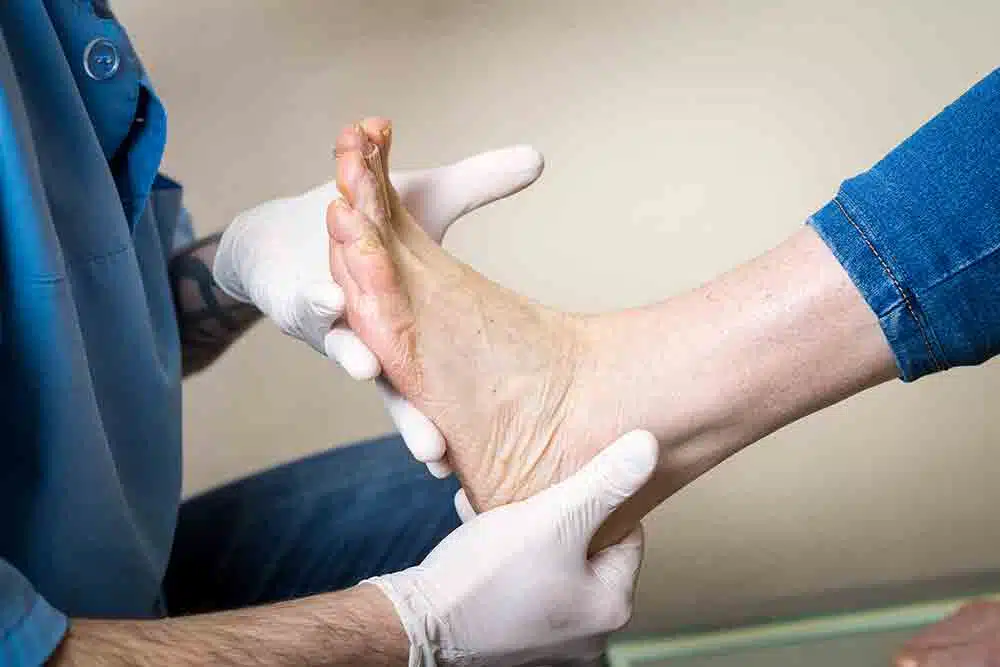 Effective treatments for fungal infections, calluses, and other nail and skin conditions at Brooklin Foot & Orthotic Clinic in Oshawa