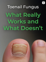 Toenail Fungus: What Really Works (and What Doesn’t)