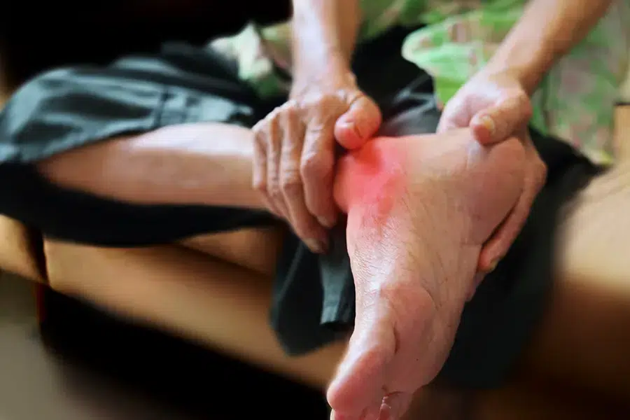 Person examining the sole of their foot for pain, skin changes, swelling, numbness or other foot symptoms that may require professional assessment